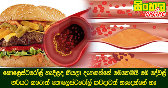 කොලෙස්ටරෝල් හැදිලද කියලා දැනගන්නේ මෙහෙමයි මේ දේවල් හරියට කරොත් කොලෙස්ටරෝල් කවදාවත් හැදෙන්නේ නෑ.
