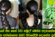 වේගයෙන් හිස කෙස් වවා ගමුද? මෙන්න අදහාගන්න බැරි විස්මිත අත්බෙහෙත ඔබට නිවසේදීම හදාගන්න පුළුවන්.