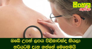 ඔබේ උපන් ලපය පිළිකාවක්ද කියලා හරියටම දැන ගන්නේ මෙහෙමයි.