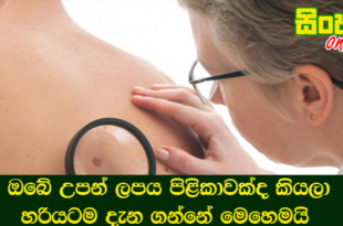 ඔබේ උපන් ලපය පිළිකාවක්ද කියලා හරියටම දැන ගන්නේ මෙහෙමයි.