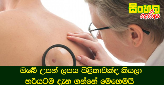 ඔබේ උපන් ලපය පිළිකාවක්ද කියලා හරියටම දැන ගන්නේ මෙහෙමයි.