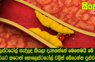 කොලෙස්ටරෝල් හැදිලද කියලා දැනගන්නේ මෙහෙමයි මේ දේවල් හරියට කරොත් කොලෙස්ටරෝල් වලින් බේරෙන්න පුළුවන්.