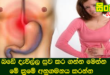 බඩේ දැවිල්ල සුව කර ගන්න මෙන්න මේ ක්‍රමේ අනුගමනය කරන්න.