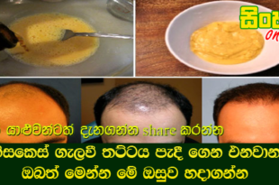හිසකෙස් ගැලවී තට්ටය පැදීගෙන එනවානම් ඔබත් මෙන්න මේ ඔසුව හදාගන්න.