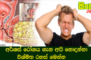 අර්ශස් රෝගය ගැන අපි නොදන්නා විශ්මිත රහස් මෙන්න.