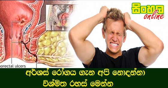 අර්ශස් රෝගය ගැන අපි නොදන්නා විශ්මිත රහස් මෙන්න.