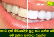 කහපාට දත් නිවසේදීම සුදු කර ගන්න මෙන්න මේ ක‍්‍රමය අත්හදා බලන්න.