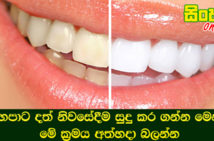 කහපාට දත් නිවසේදීම සුදු කර ගන්න මෙන්න මේ ක‍්‍රමය අත්හදා බලන්න.